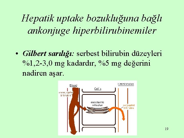 Hepatik uptake bozukluğuna bağlı ankonjuge hiperbilirubinemiler • Gilbert sarılığı: serbest bilirubin düzeyleri %1, 2