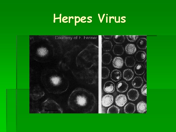 Herpes Virus 