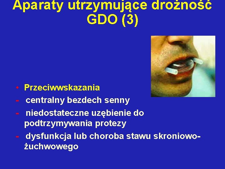 Aparaty utrzymujące drożność GDO (3) • Przeciwwskazania - centralny bezdech senny - niedostateczne uzębienie