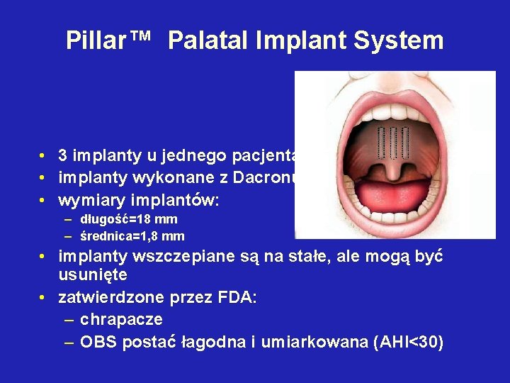Pillar™ Palatal Implant System • 3 implanty u jednego pacjenta • implanty wykonane z