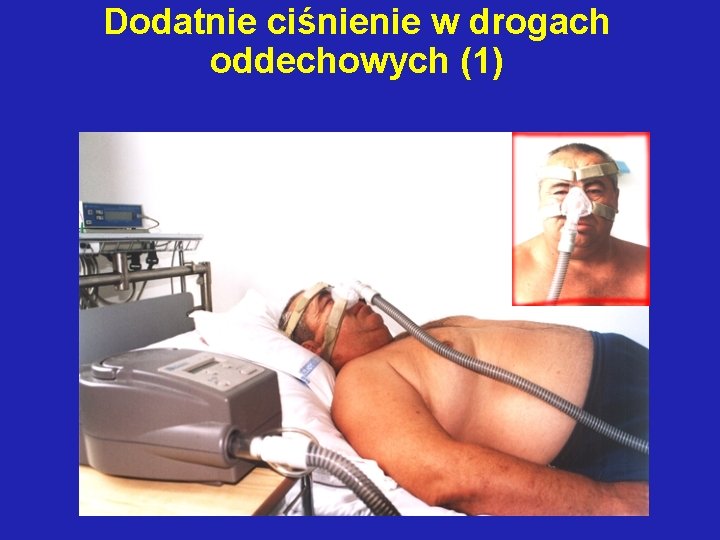 Dodatnie ciśnienie w drogach oddechowych (1) 