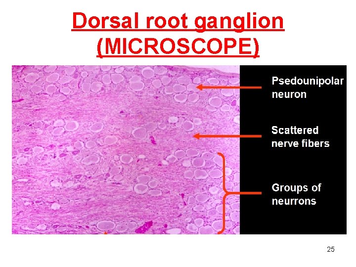 Dorsal root ganglion (MICROSCOPE) 25 