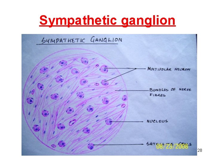 Sympathetic ganglion 28 