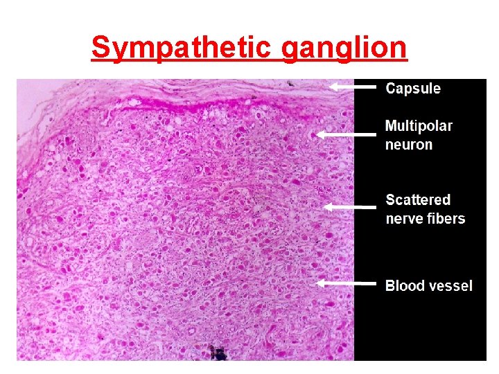 Sympathetic ganglion 29 