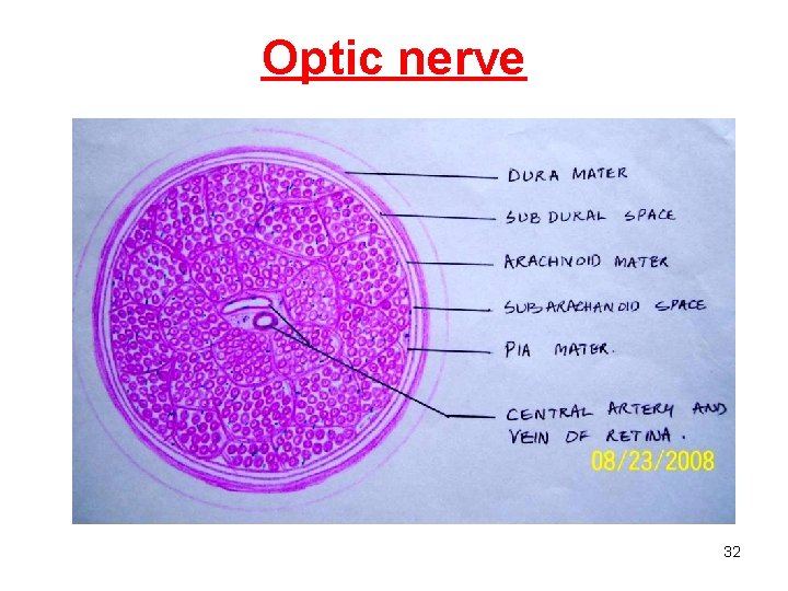 Optic nerve 32 