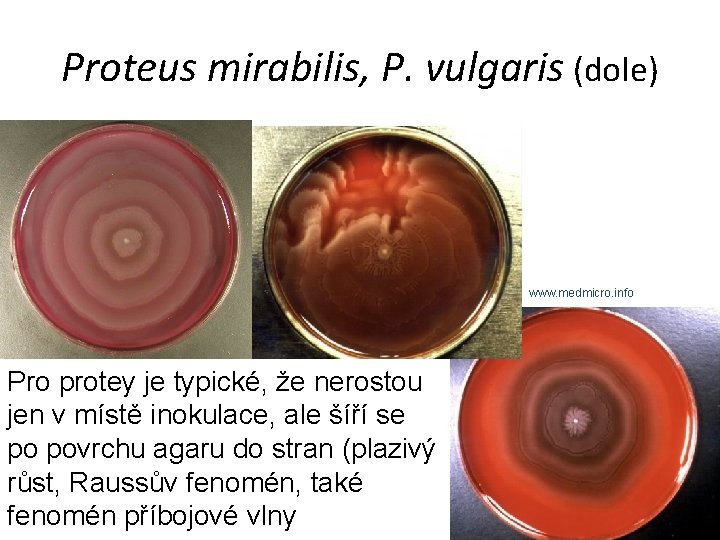 Proteus mirabilis, P. vulgaris (dole) www. medmicro. info Pro protey je typické, že nerostou