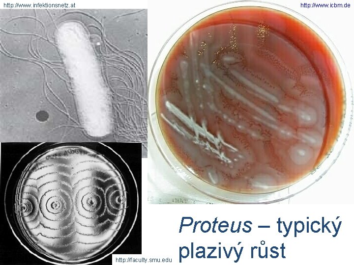 http: //www. infektionsnetz. at http: //www. icbm. de http: //faculty. smu. edu Proteus –