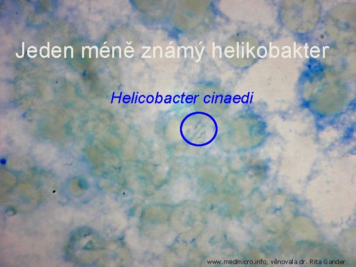 Jeden méně známý helikobakter Helicobacter cinaedi www. medmicro. info, věnovala dr. Rita Gander 