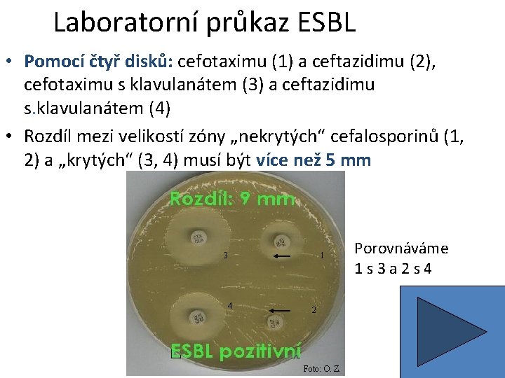 Laboratorní průkaz ESBL • Pomocí čtyř disků: cefotaximu (1) a ceftazidimu (2), cefotaximu s