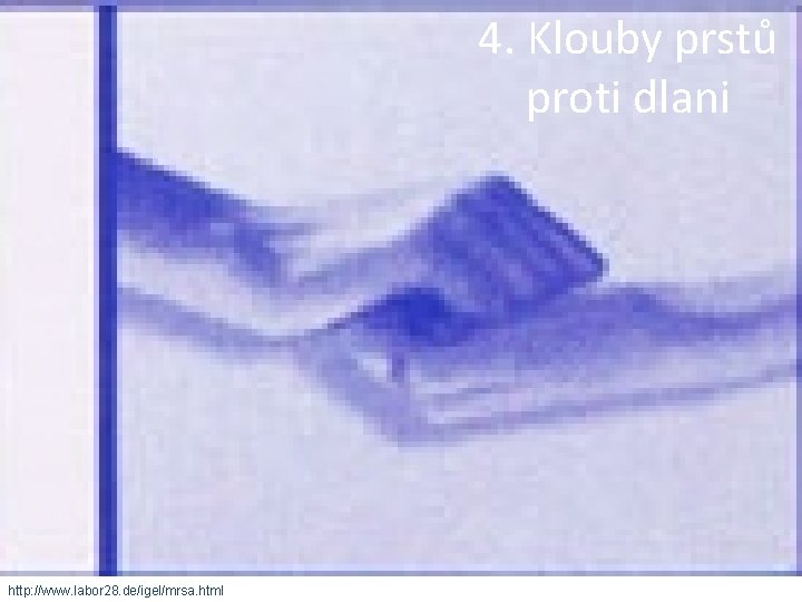 4. Klouby prstů proti dlani http: //www. labor 28. de/igel/mrsa. html 