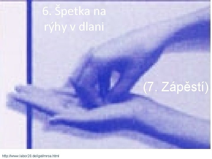 6. Špetka na rýhy v dlani (7. Zápěstí) http: //www. labor 28. de/igel/mrsa. html