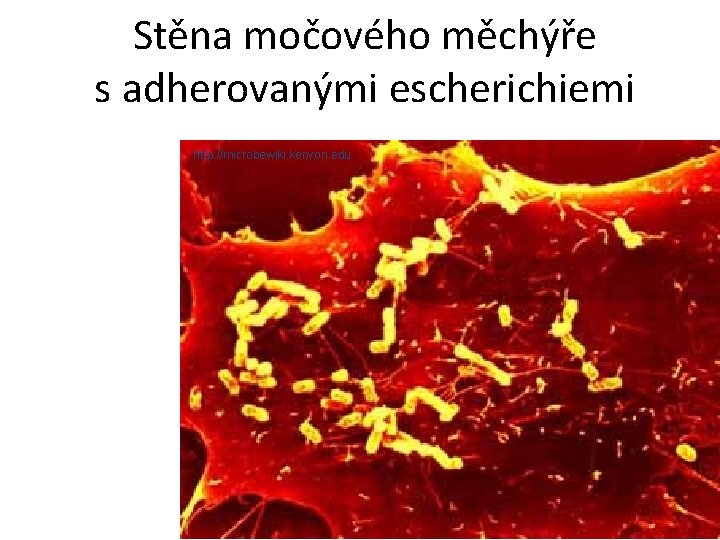 Stěna močového měchýře s adherovanými escherichiemi http: //microbewiki. kenyon. edu 