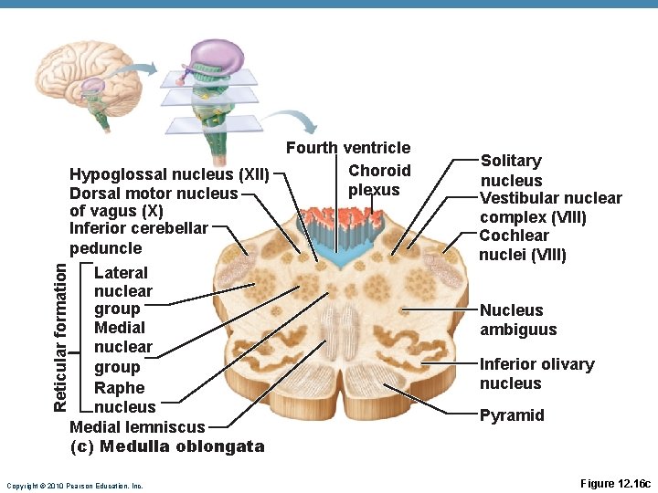 Reticular formation Fourth ventricle Choroid Hypoglossal nucleus (XII) plexus Dorsal motor nucleus of vagus