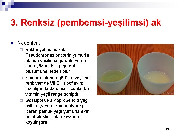 3. Renksiz (pembemsi-yeşilimsi) ak n Nedenleri; Bakteriyel bulaşıklık; Pseudomonas bacteria yumurta akında yeşilimsi görüntü