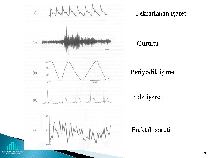 Tekrarlanan işaret Gürültü Periyodik işaret Tıbbi işaret Fraktal işareti 33 