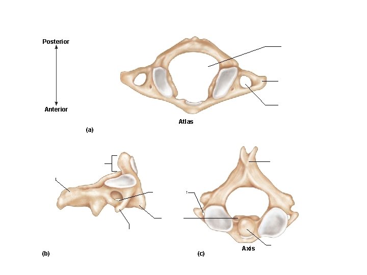 Posterior Vertebral foramen Transverse process Transverse foramen Anterior Atlas (a) Spinous process Dens Transverse