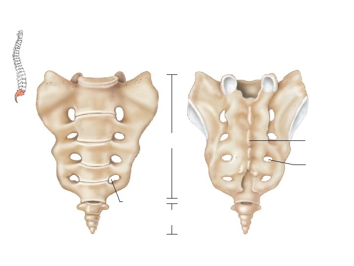 Anatomy and Physiology Bone Identification Hyoid bone Coronal