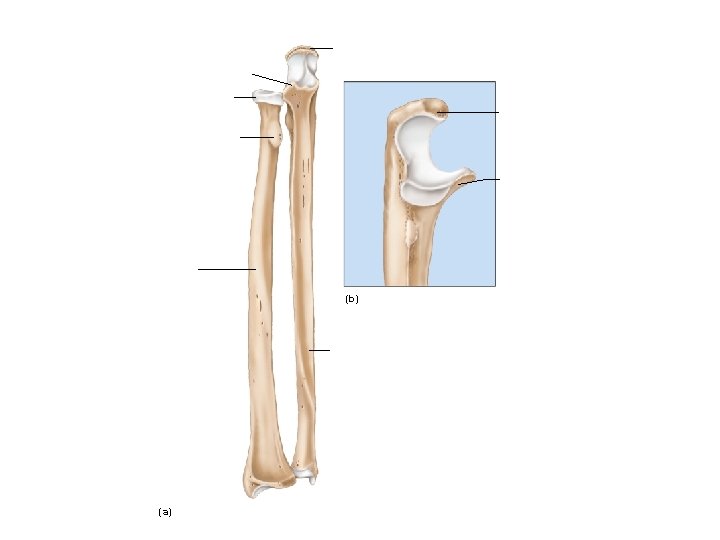 Olecranon process Coronoid process Head of radius Olecranon process Radial tuberosity Coronoid process Radius