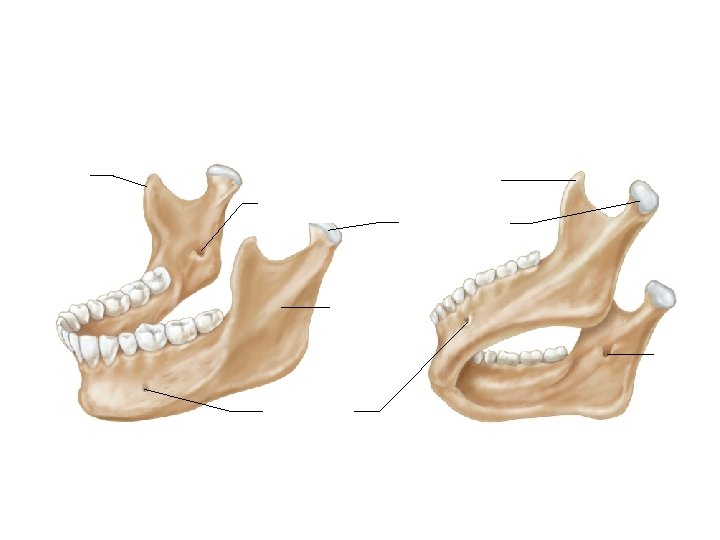 Coronoid process Mandibular foramen Mandibular condyle Ramus Mandibular foramen Mental foramen 