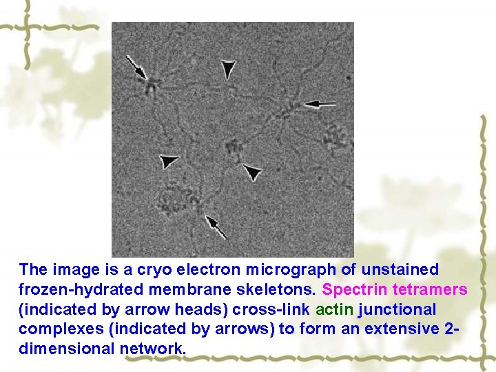 The image is a cryo electron micrograph of unstained frozen-hydrated membrane skeletons. Spectrin tetramers