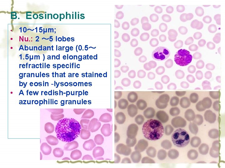 B. Eosinophilis 10～ 15μm; • Nu. : 2 ～ 5 lobes • Abundant large