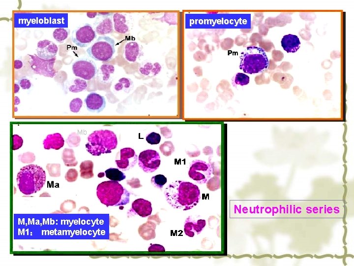 myeloblast promyelocyte Mb Neutrophilic series M, Ma, Mb: myelocyte M 1： metamyelocyte 