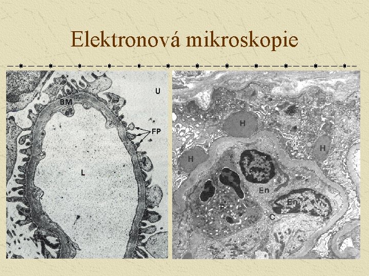 Elektronová mikroskopie 
