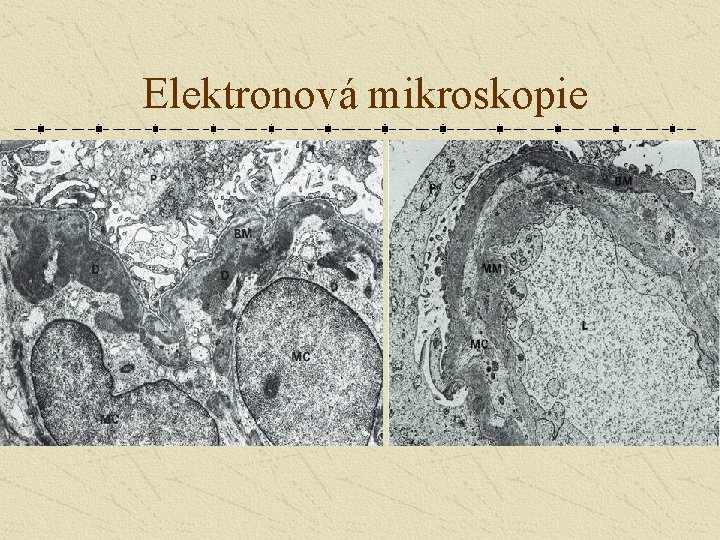Elektronová mikroskopie 