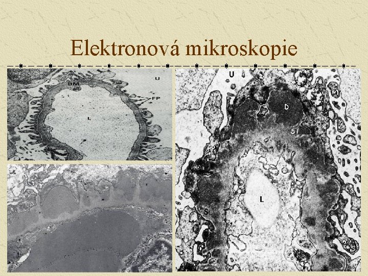 Elektronová mikroskopie 