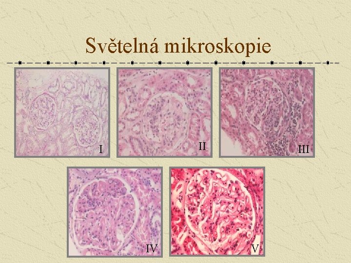 Světelná mikroskopie II I IV III V 