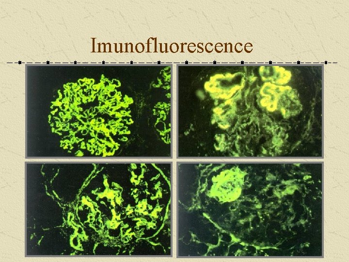 Imunofluorescence 