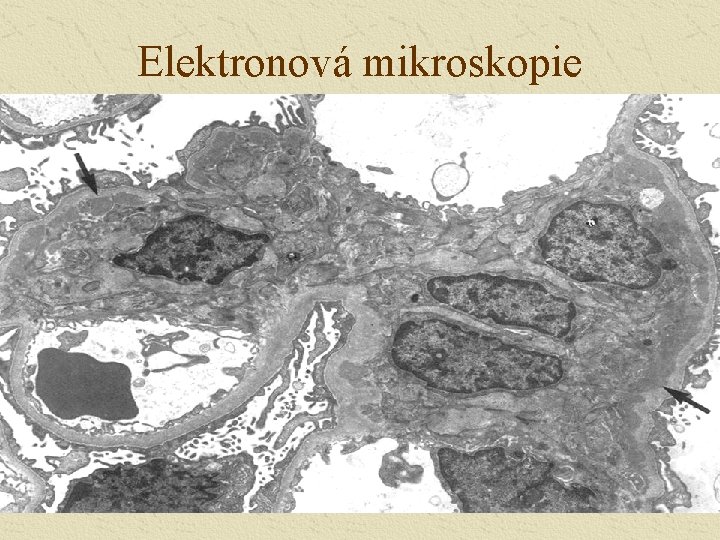 Elektronová mikroskopie 