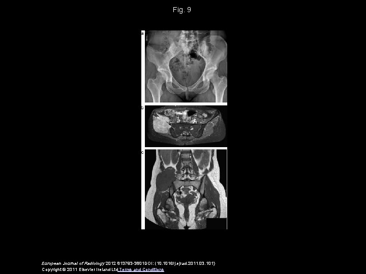 Fig. 9 European Journal of Radiology 2012 813793 -3801 DOI: (10. 1016/j. ejrad. 2011.