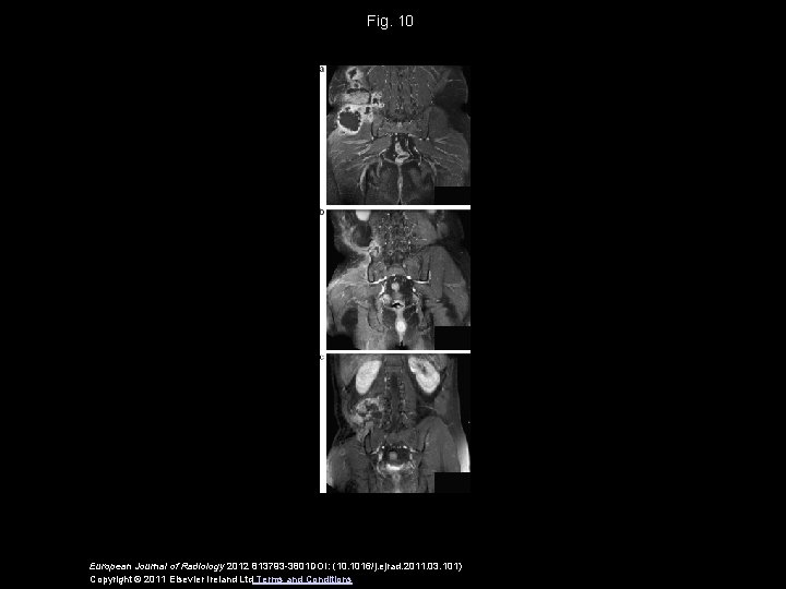 Fig. 10 European Journal of Radiology 2012 813793 -3801 DOI: (10. 1016/j. ejrad. 2011.