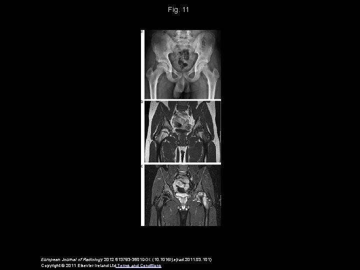Fig. 11 European Journal of Radiology 2012 813793 -3801 DOI: (10. 1016/j. ejrad. 2011.