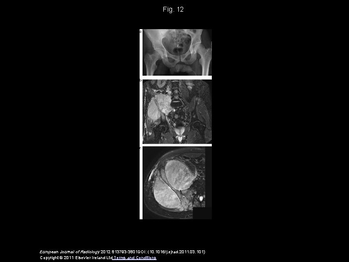 Fig. 12 European Journal of Radiology 2012 813793 -3801 DOI: (10. 1016/j. ejrad. 2011.