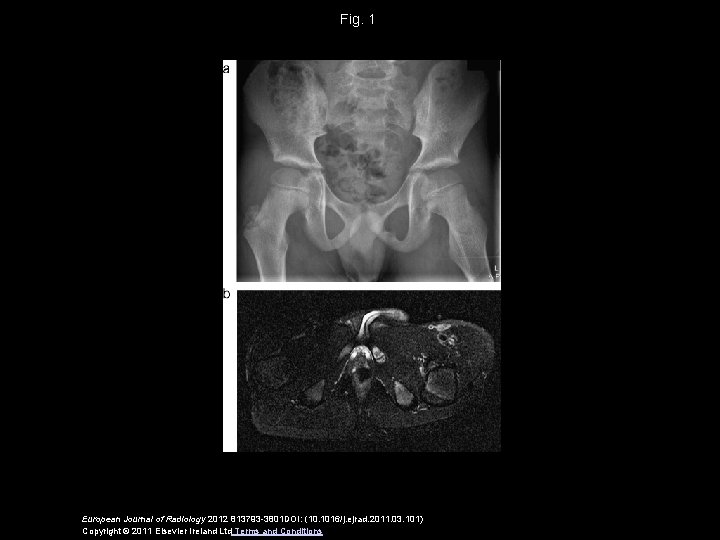 Fig. 1 European Journal of Radiology 2012 813793 -3801 DOI: (10. 1016/j. ejrad. 2011.