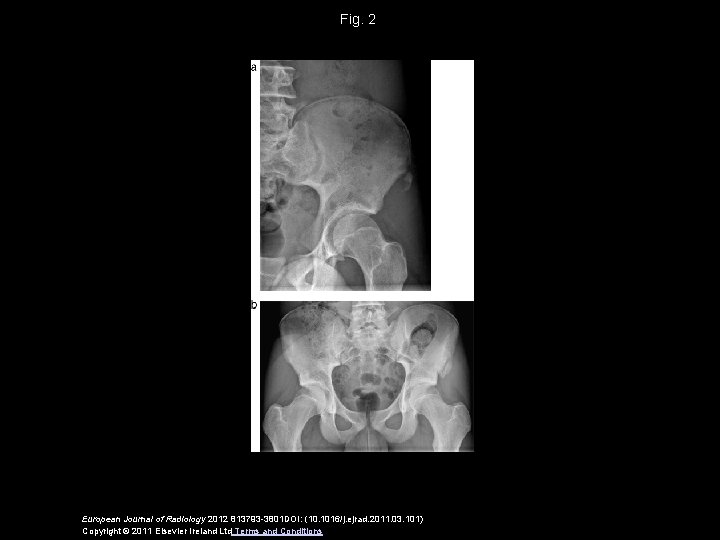 Fig. 2 European Journal of Radiology 2012 813793 -3801 DOI: (10. 1016/j. ejrad. 2011.