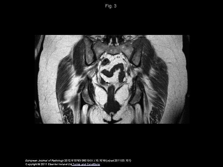 Fig. 3 European Journal of Radiology 2012 813793 -3801 DOI: (10. 1016/j. ejrad. 2011.