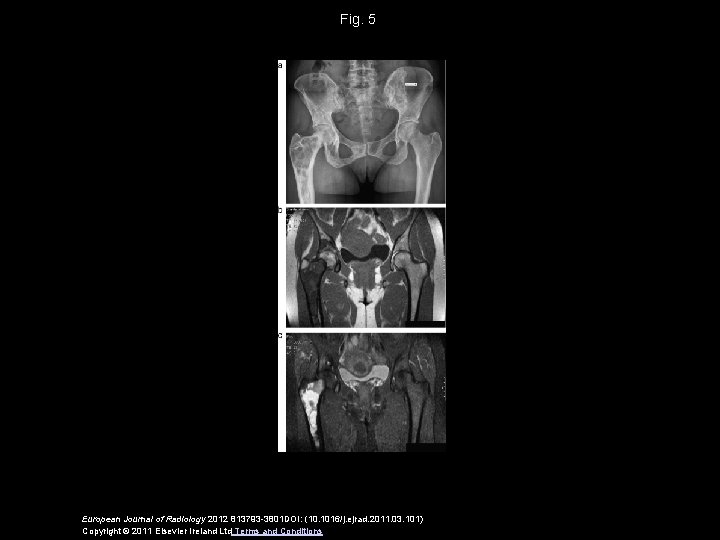 Fig. 5 European Journal of Radiology 2012 813793 -3801 DOI: (10. 1016/j. ejrad. 2011.