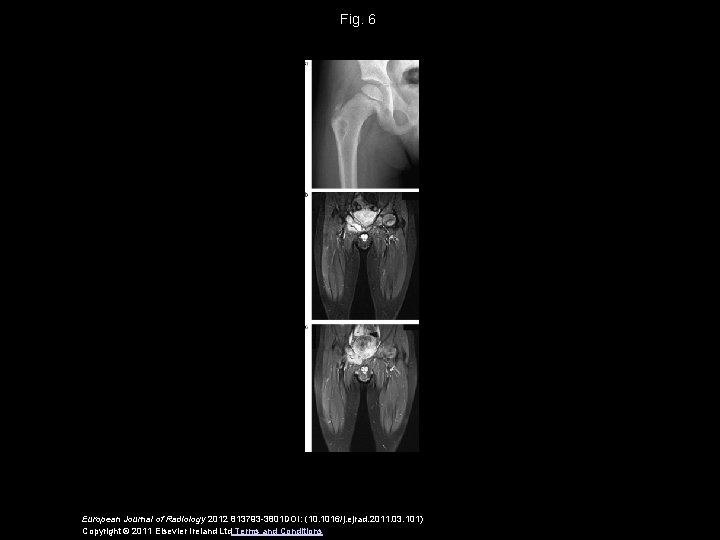 Fig. 6 European Journal of Radiology 2012 813793 -3801 DOI: (10. 1016/j. ejrad. 2011.