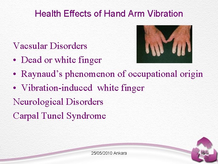 Health Effects of Hand Arm Vibration Vacsular Disorders • Dead or white finger •