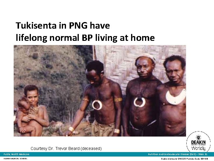 Tukisenta in PNG have lifelong normal BP living at home Courtesy Dr. Trevor Beard