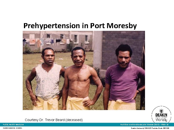 Prehypertension in Port Moresby Courtesy Dr. Trevor Beard (deceased) Public Health Medicine DEAKIN MEDICAL