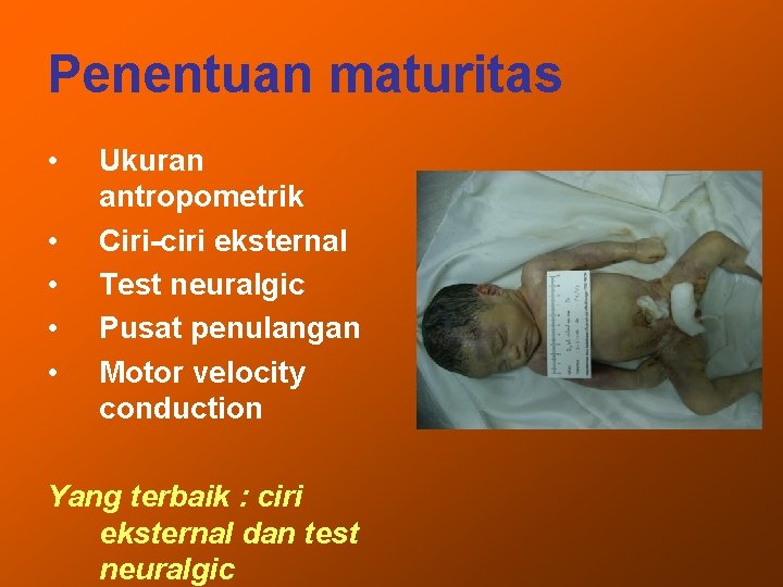 Penentuan maturitas • • • Ukuran antropometrik Ciri-ciri eksternal Test neuralgic Pusat penulangan Motor