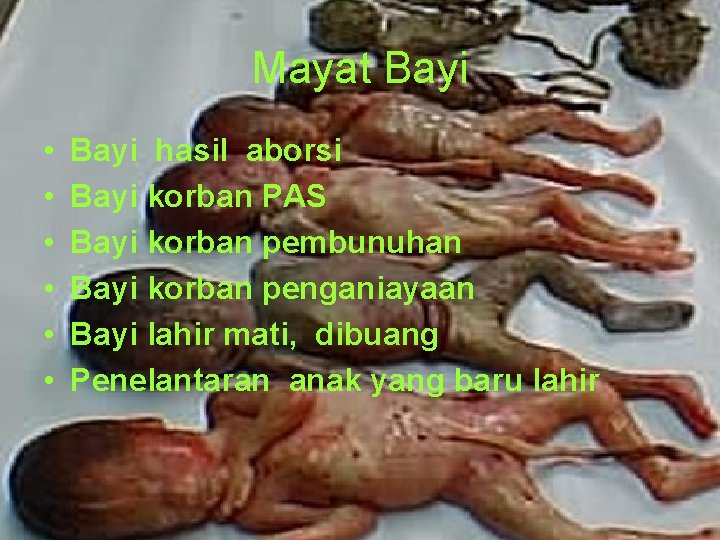 Mayat Bayi • • • Bayi hasil aborsi Bayi korban PAS Bayi korban pembunuhan