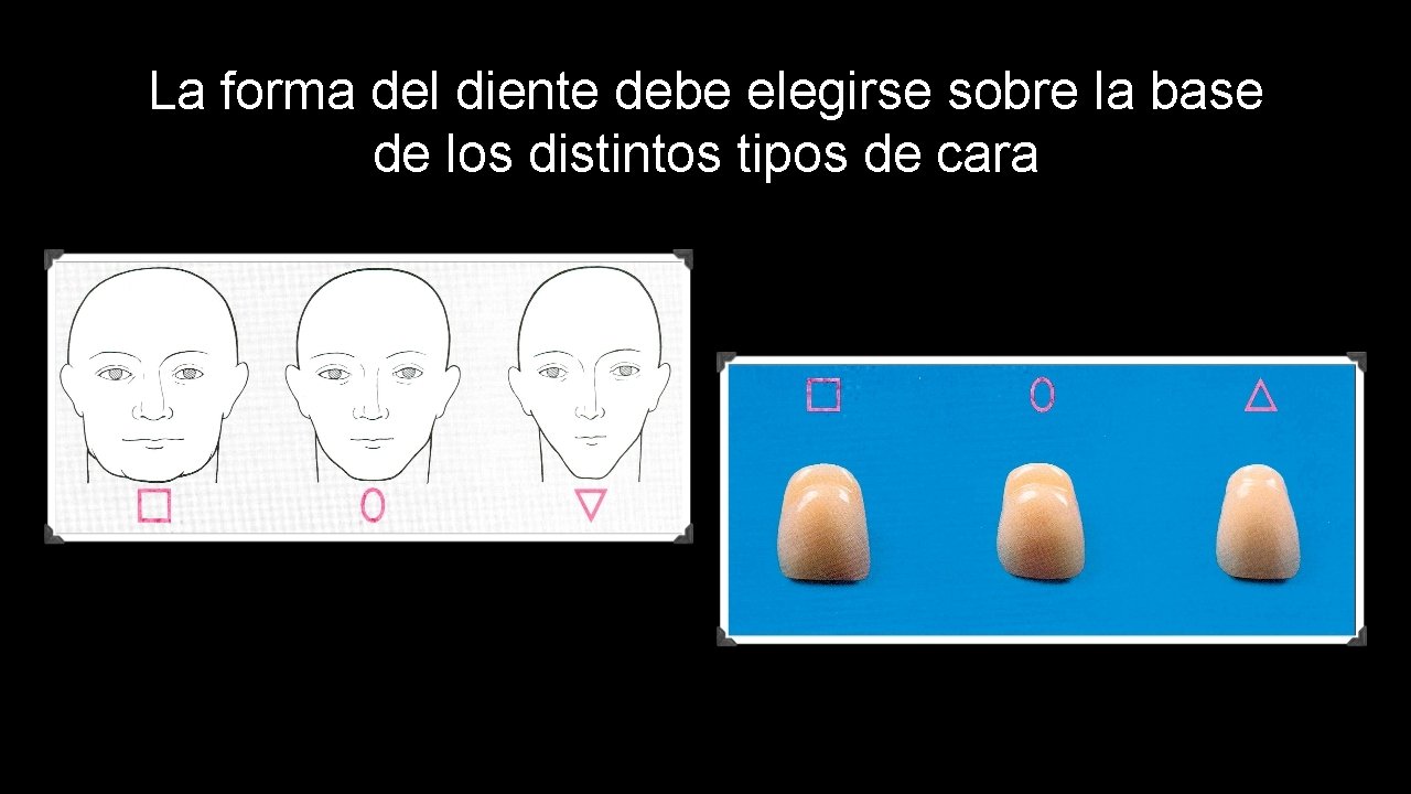 La forma del diente debe elegirse sobre la base de los distintos tipos de