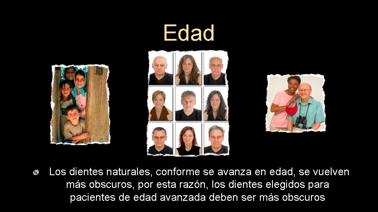 Edad Los dientes naturales, conforme se avanza en edad, se vuelven más obscuros, por