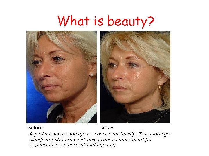 What is beauty? 