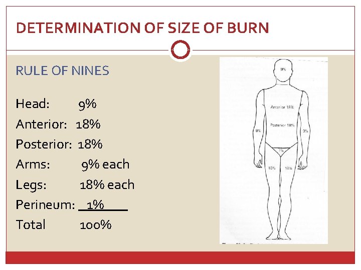 DETERMINATION OF SIZE OF BURN RULE OF NINES Head: 9% Anterior: 18% Posterior: 18%